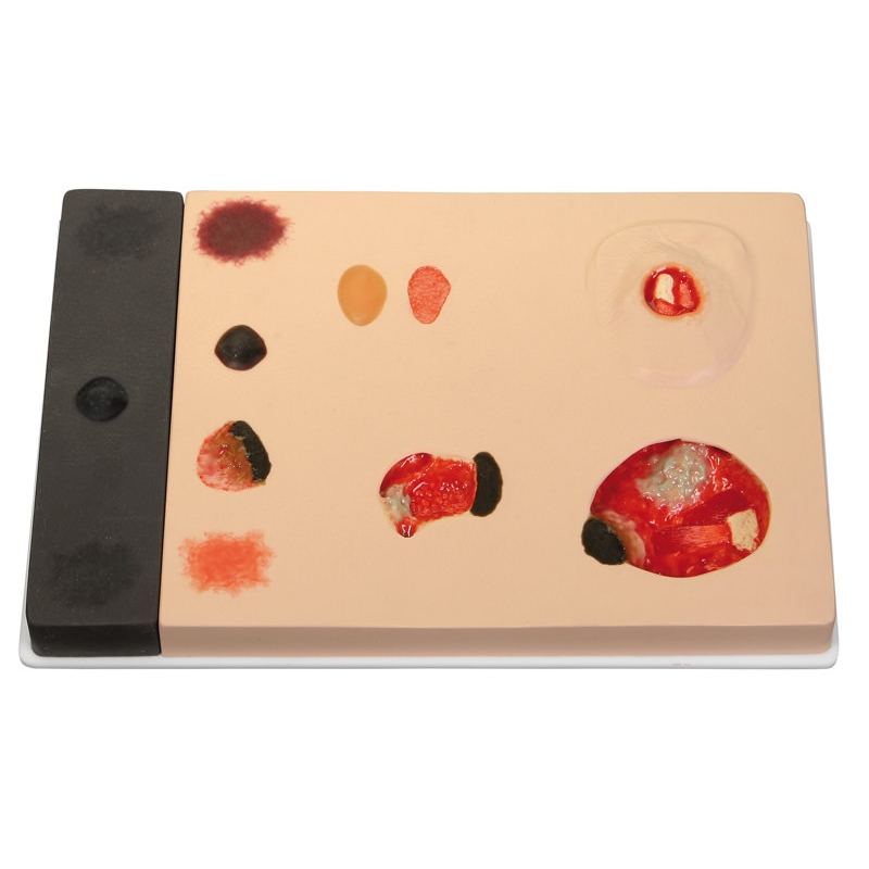 Model poškodbe zaradi pritiska