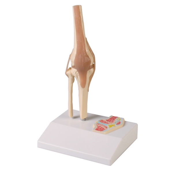 Miniaturni kolenski sklep s prečnim prerezom