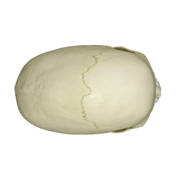 Skafocefalična lobanja