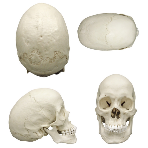 Skafocefalična lobanja