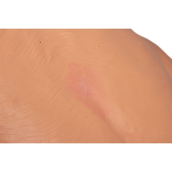 TERI Androginski vaditelj veščin za geriatrične paciente