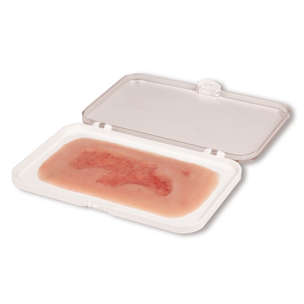 Mulaža rane venska razjeda na nogi, majhna, faza epitelizacije