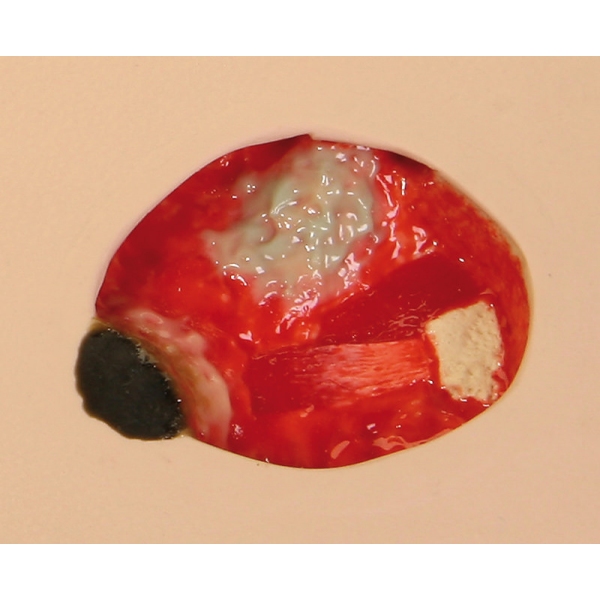 Model poškodbe zaradi pritiska