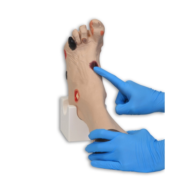 Rana stopala "Wilma"