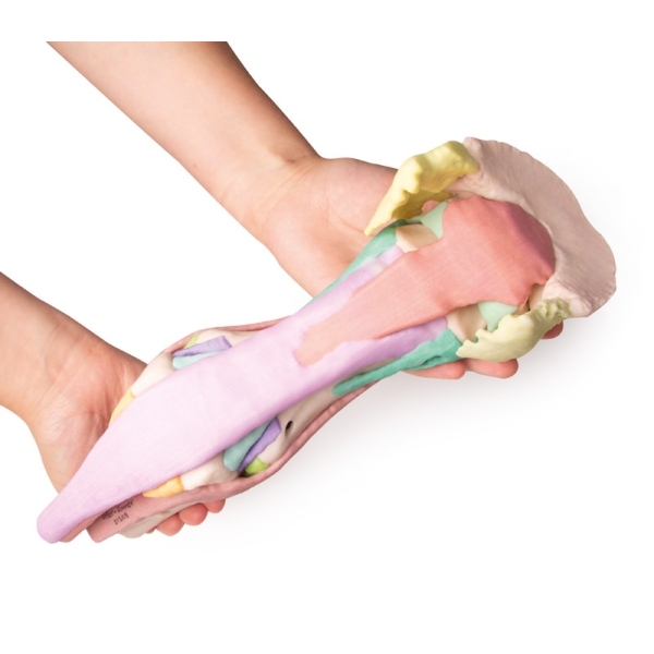 Konjsko stopalo kot model - Model 1