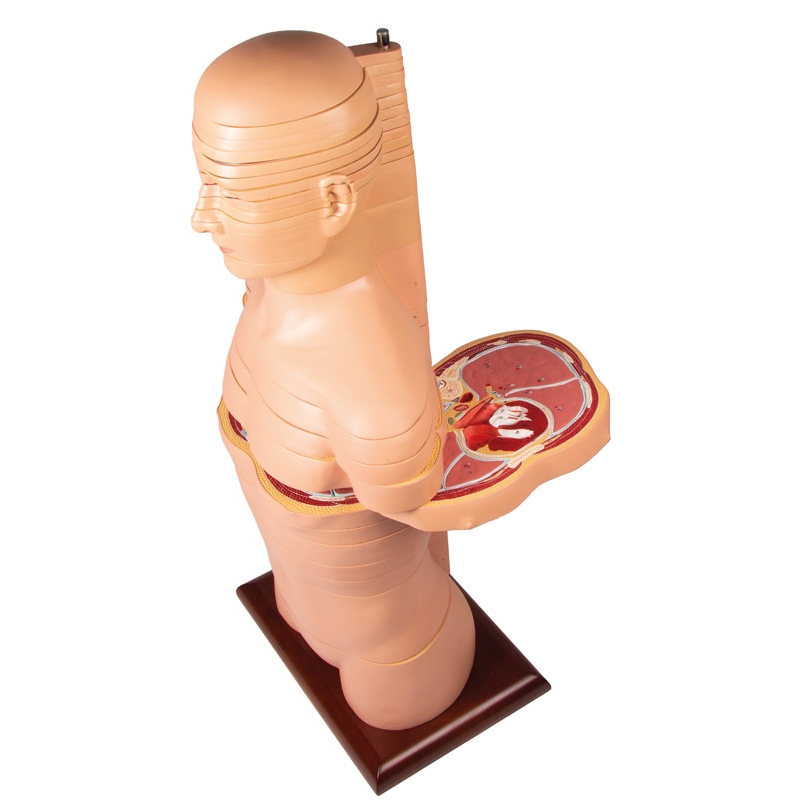 Torzo diska, naravna velikost