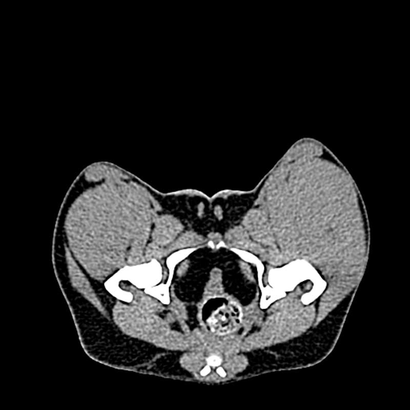Fantom pasje medenice za CT in rentgensko slikanje
