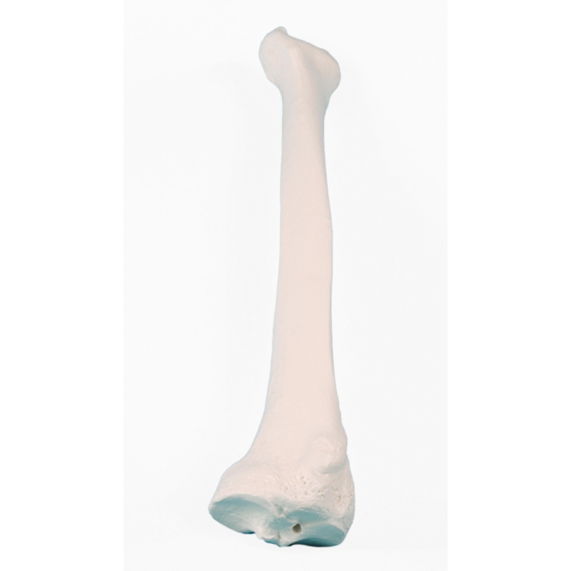 Radius