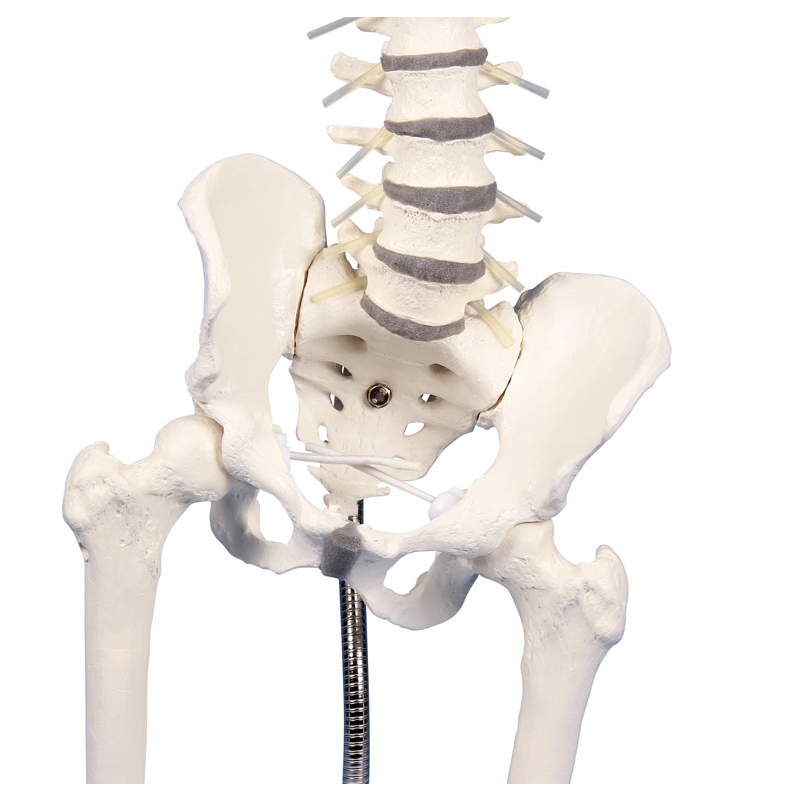 Lumbarna hrbtenica z medenico za prikaz nepravilnega položaja