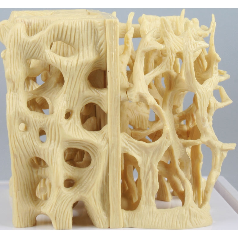 Primerjalni model strukture zdrave / osteoporozne kosti