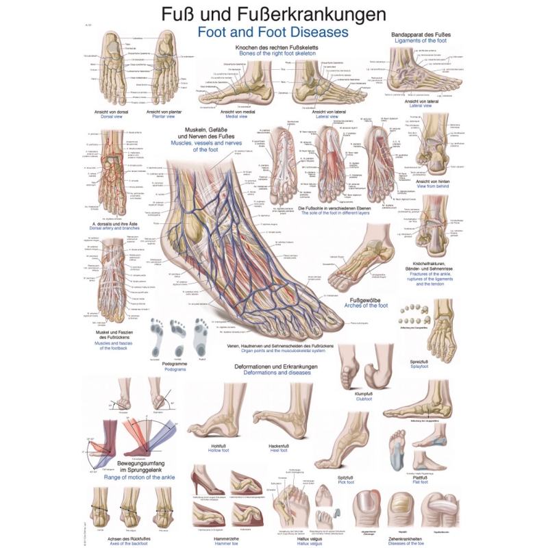 Diagram Bolezni stopal in stopal, 70x100cm (Angleški)