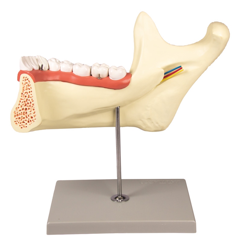 Lower jaw, 6 parts