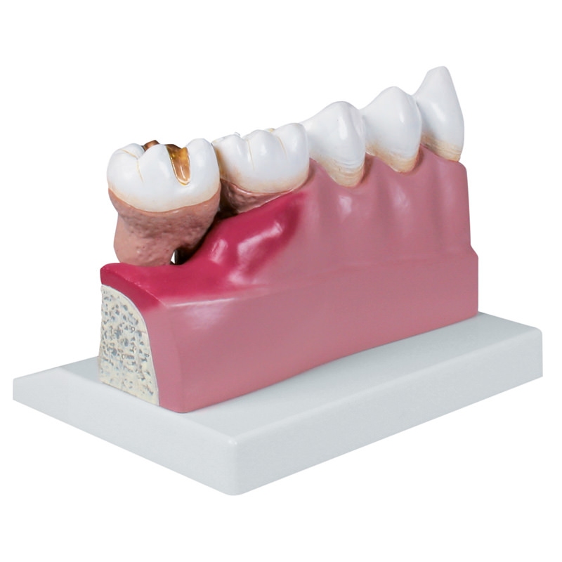 Model zob, 4-krat v naravni velikosti - EZ Augmented Anatomy