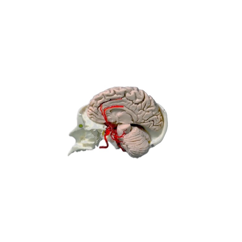 Arterije