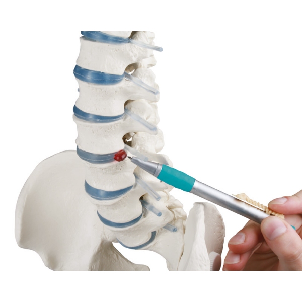 Standardna hrbtenica s prolapsom in medenica