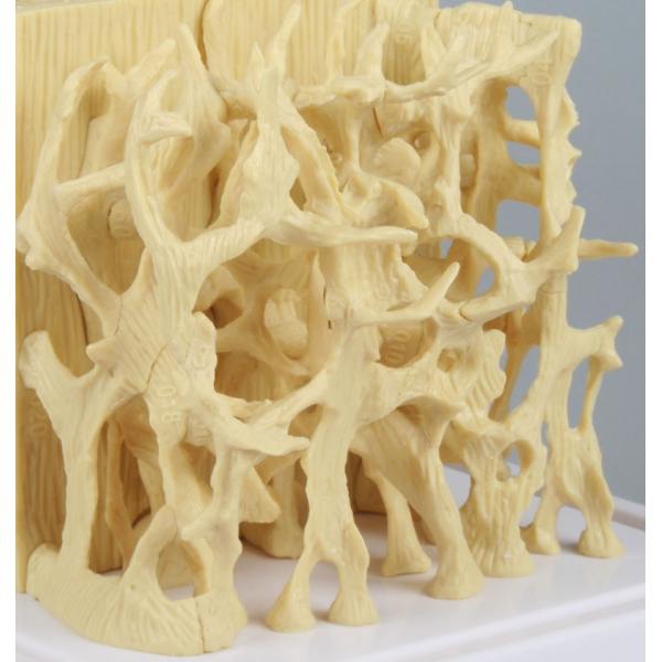 Primerjalni model strukture zdrave / osteoporozne kosti