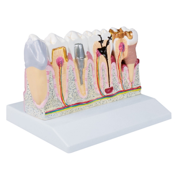 Model zob, 4-krat v naravni velikosti - EZ Augmented Anatomy