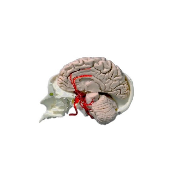 Arterije