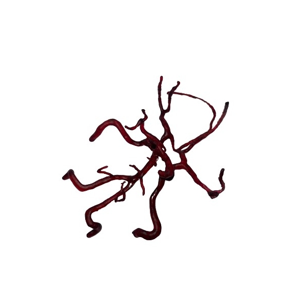 Arterije