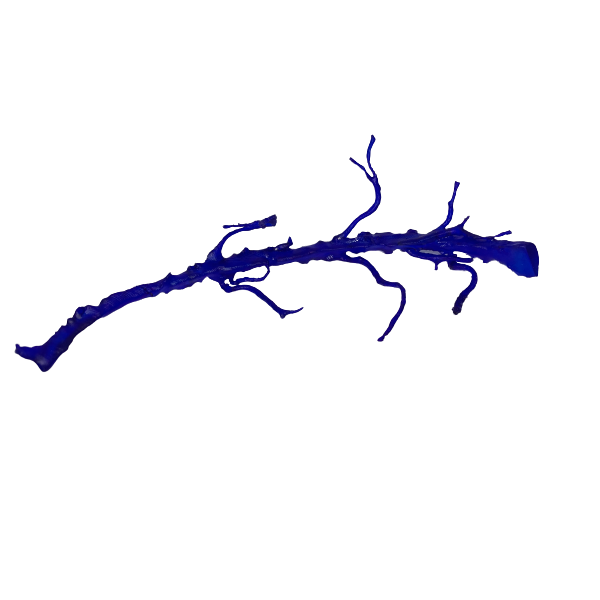Venski duralni sinus