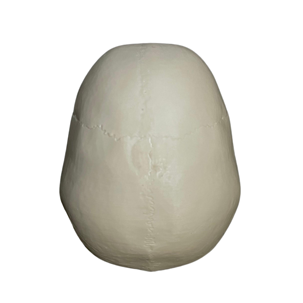Odprtine z luknjami Calvarium