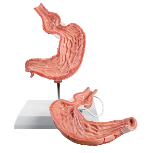 Model želodca z želodčnim trakom